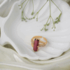 vosgi ring